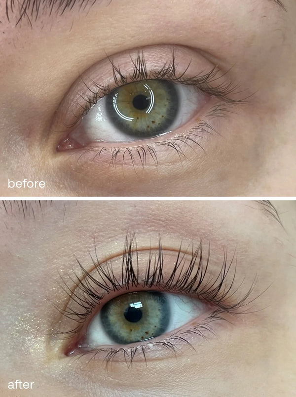 TLOPA® Eyelash Serum – Clinically Proven to Boost Growth, Transform Short & Sparse Lashes 6 Weeks to Longer Lashes!